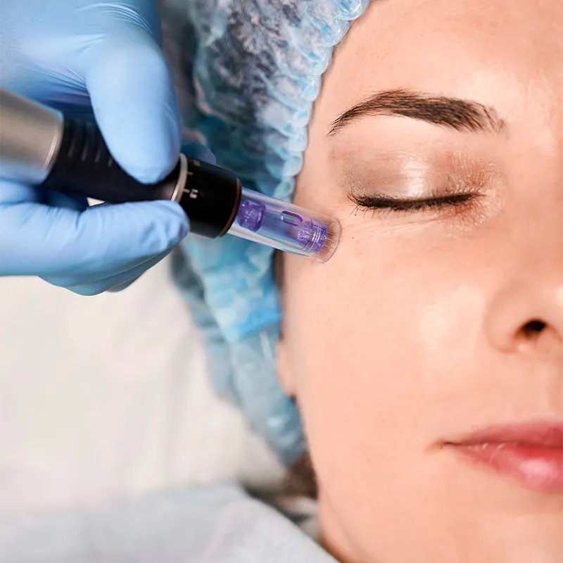 Tratamientos en medicina estetica y dermatologia