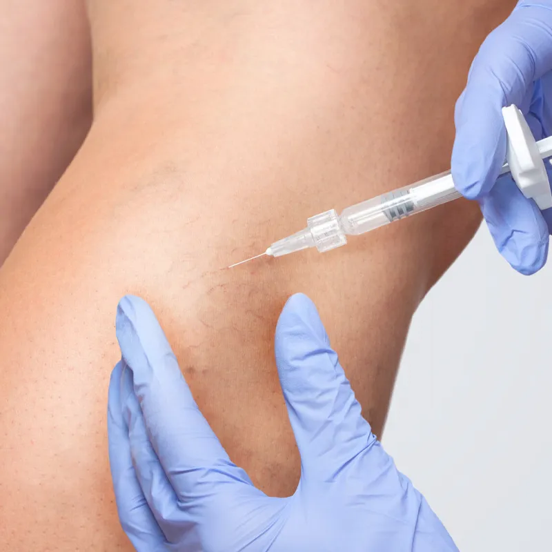 Tratamientos en medicina estetica y dermatologia