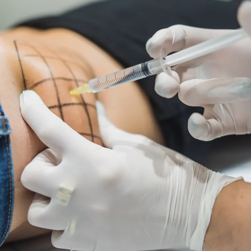 Tratamientos en medicina estetica y dermatologia